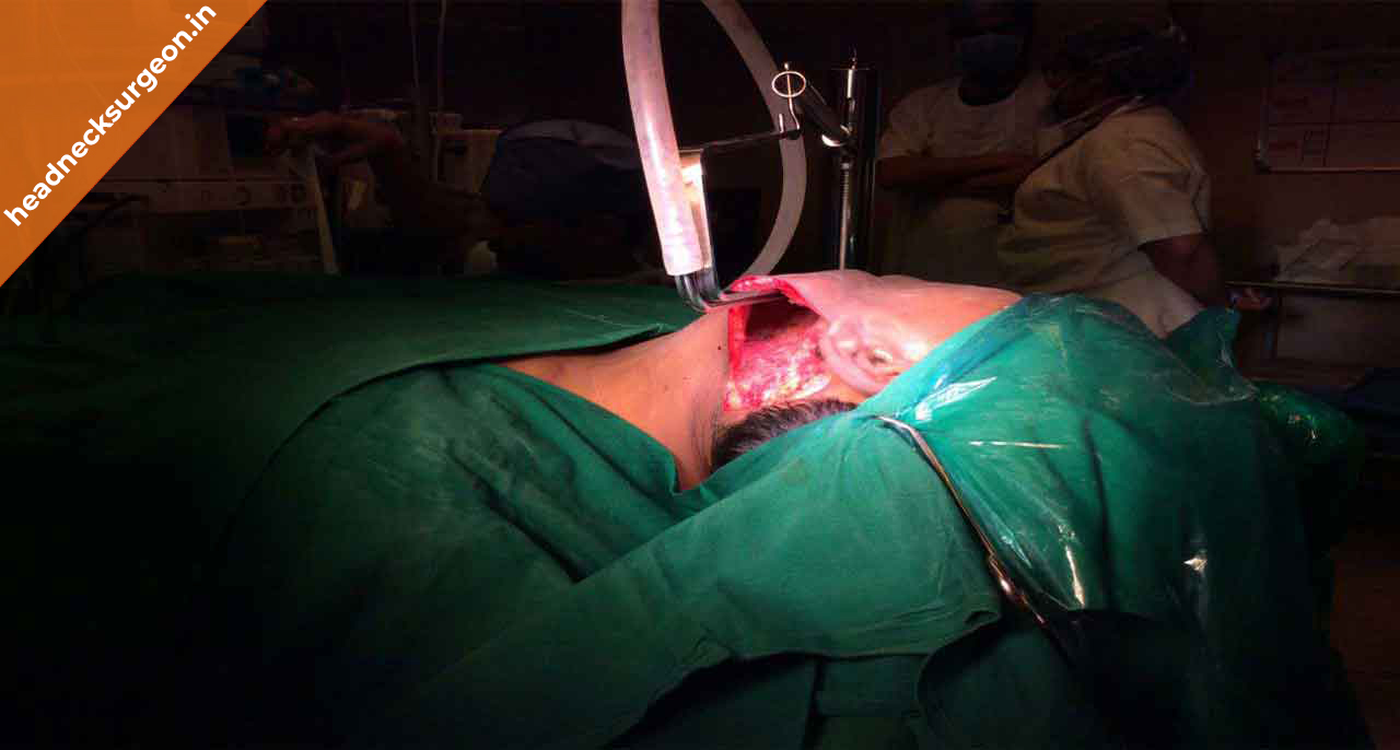 minimal-access-surgery